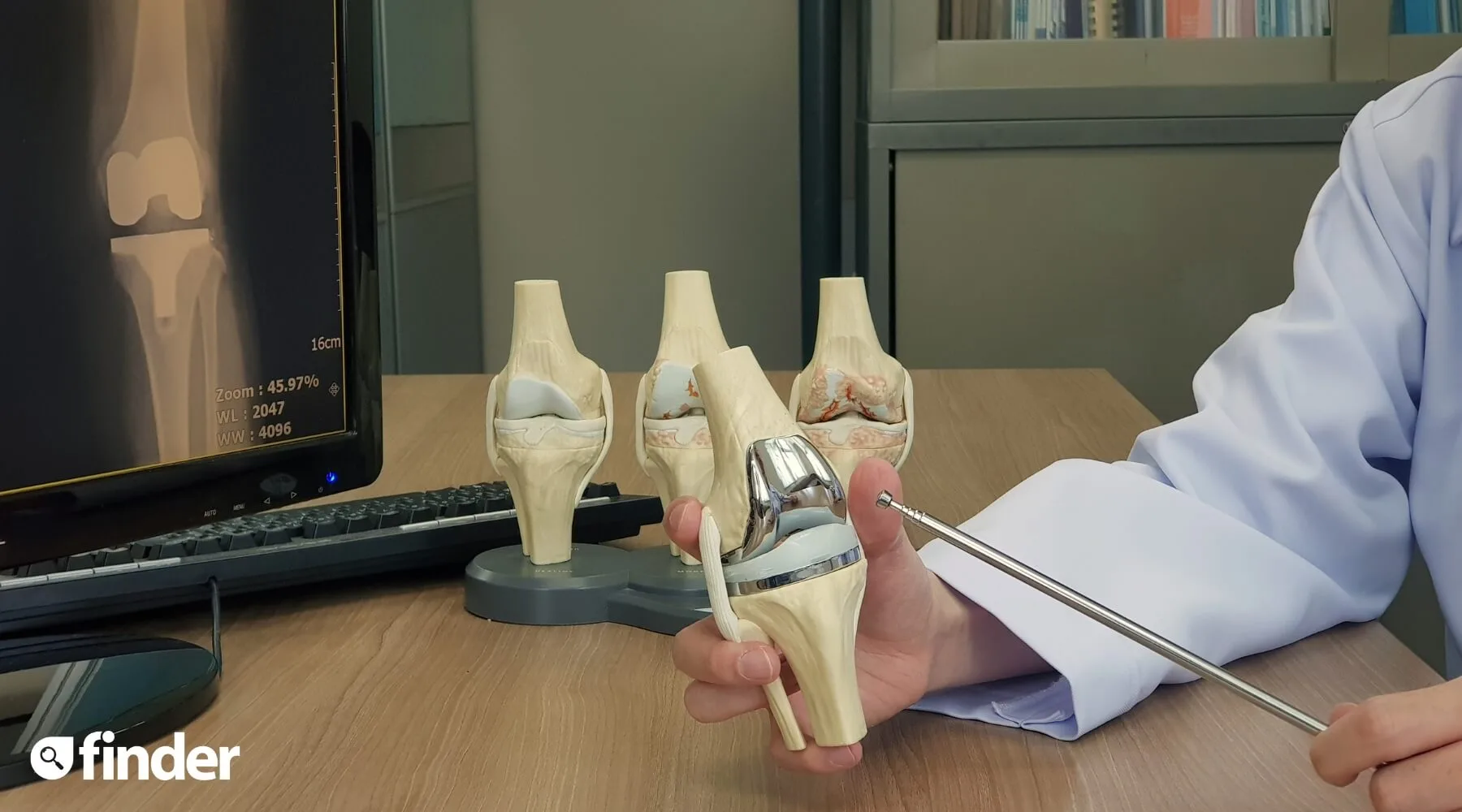 Compare Public & Private Health Insurance Knee Surgery Finder