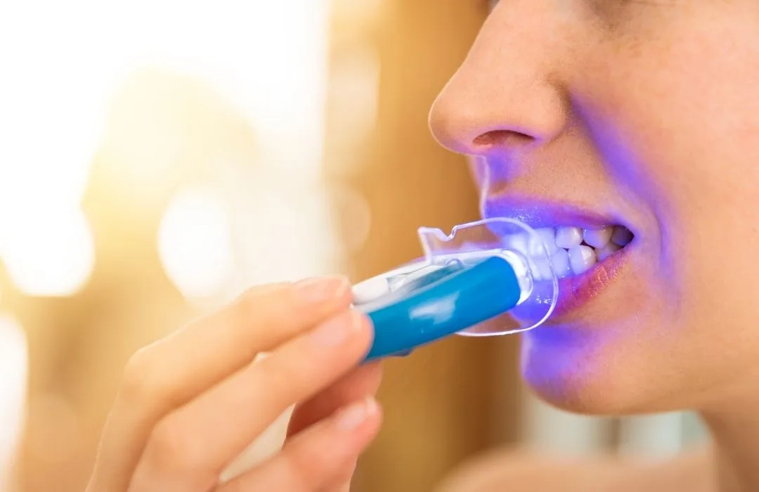 Teeth whitening guide + top picks